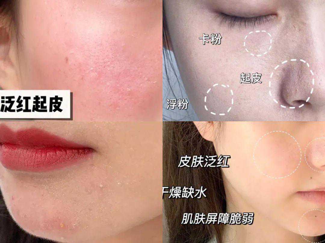 1019优选 | 599元抢天气丹7件套装，给你宫廷级护肤体验感！